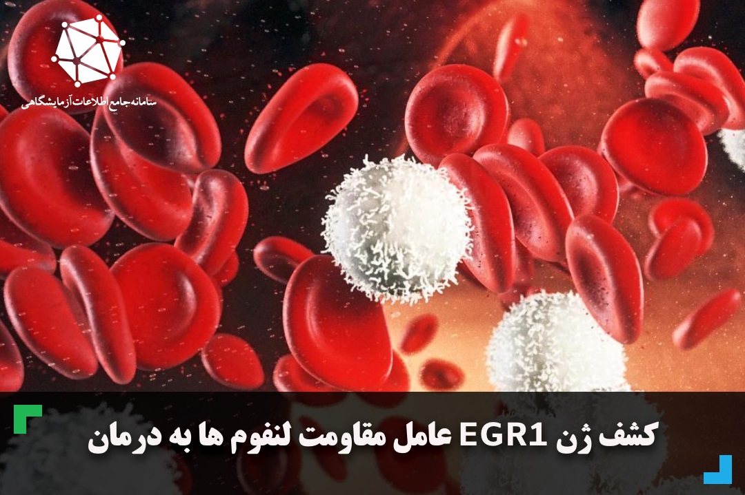 کشف ژن EGR1 عامل مقاومت لنفوم ها به درمان