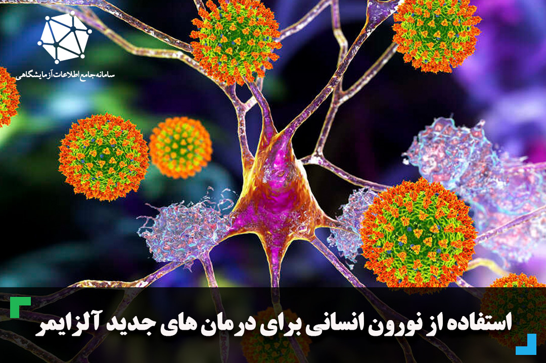 استفاده از نورون انسانی برای درمان های جدید آلزایمر